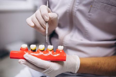 A Guide to Understanding Dental Implants Options: Explanation and Details